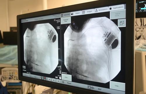 Анастасия Ракова рассказала о технологии, помогающей предотвратить внезапную смерть при болезнях сердца в Москве