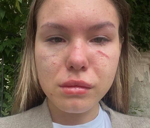 Полиция будет подводить итоги женского боя за место в очереди